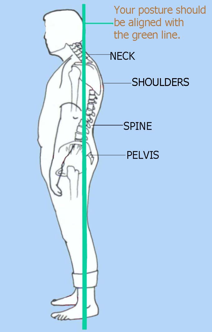 Poor Posture